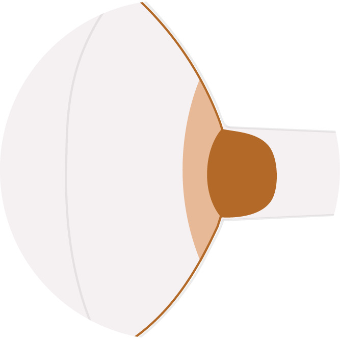 Correct flange fit: the nipple fits snugly inside the tunnel