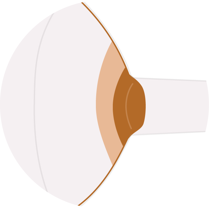 Flange too small: the nipple rubs against the tunnel
